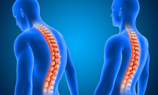 What does back pain from scoliosis feel like?