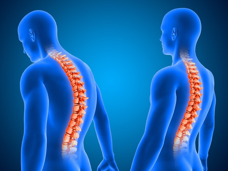 What does back pain from scoliosis feel like?